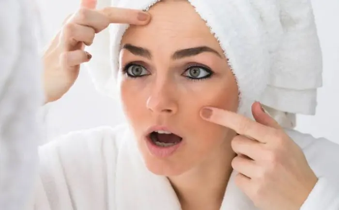 خانم مبتلا به لک پوستی روی گونه و صورت متعجب آن 845965654