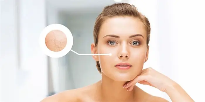 خشکی و پوسته های ایجاد شده روی صورت 54567454120
