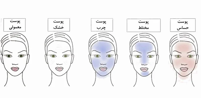 تشخیص نوع پوست 485485