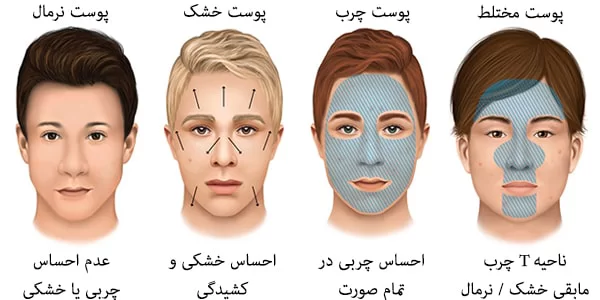 تشخیص نوع پوست 4.856985