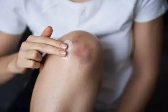 استفاده از بهترین پماد ضد درد ایرانی برای زانو 56465641