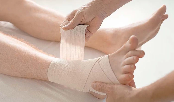بستن مچ پا بعد از پیچ خوردگی مچ پا 5464654410