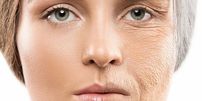 چین و چروک های پوستی 64564120