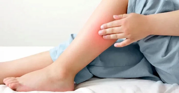 گرفتگی عضلات پا کودک بعد از ورزش 64685120