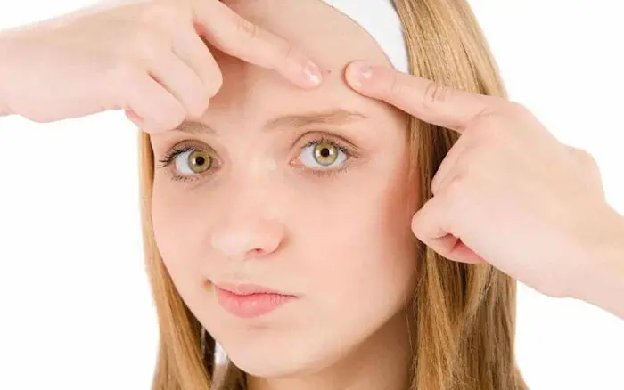 رفع جوش پیشانی 454354534