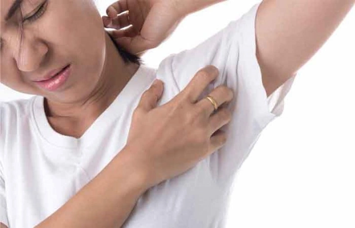 خارش زیر بغل 545651