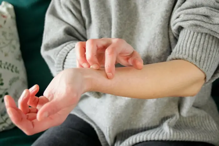 خارش پوست دست 45456120