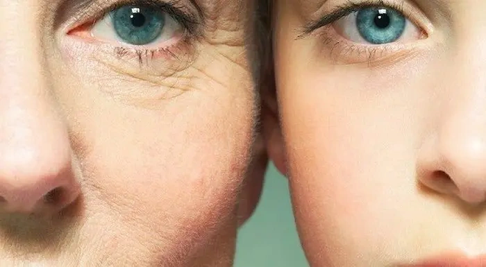 ایجاد چین و چروک های پوستی با افزایش سن 654641