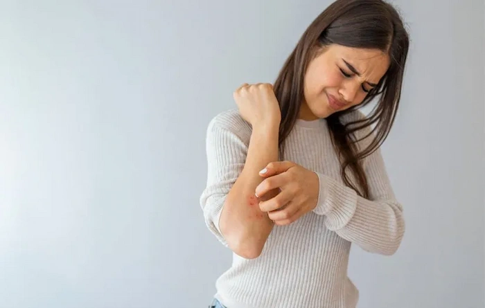 خارش شدید پوست دست 545341