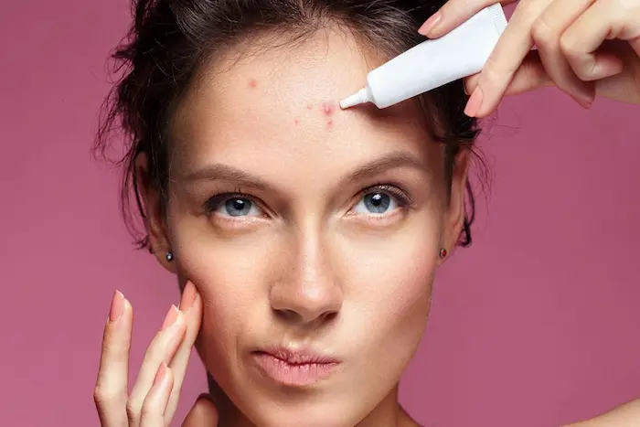 استفاده از ژل برای جوش قاعدگی 5465456