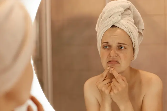 خشکیدگی و فرسودگی صورت 5454541